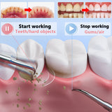 Dental Ultrasonic Scaler Tooth Cleaner