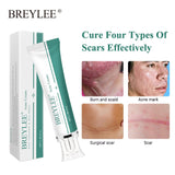 Marks Removal Cream