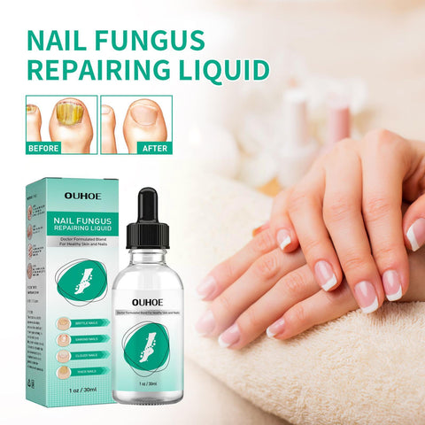 Nail Fungal Treatment