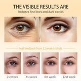 Eye Dark Circles Cream