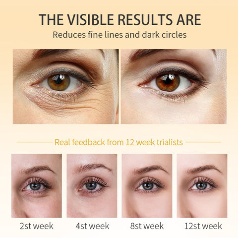 Eye Dark Circles Cream