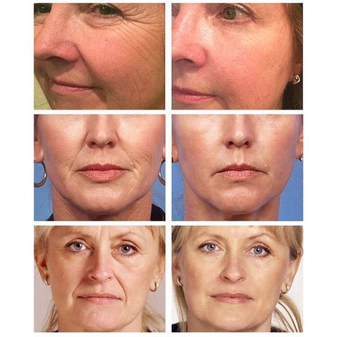 Instant Wrinkle Remover