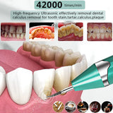 Dental Ultrasonic Scaler Tooth Cleaner