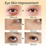 Eye Dark Circles Cream