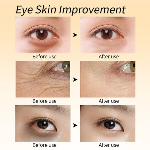 Eye Dark Circles Cream