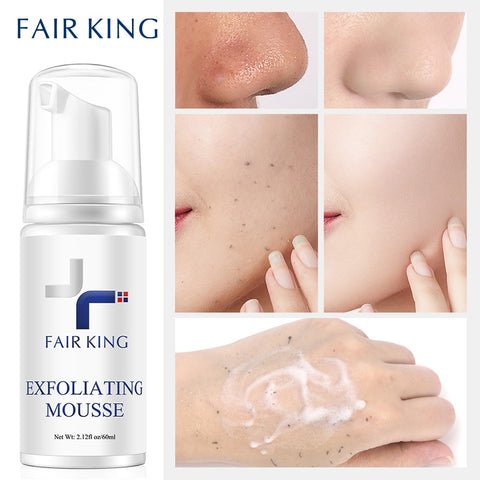 Mousse Peeling Gel