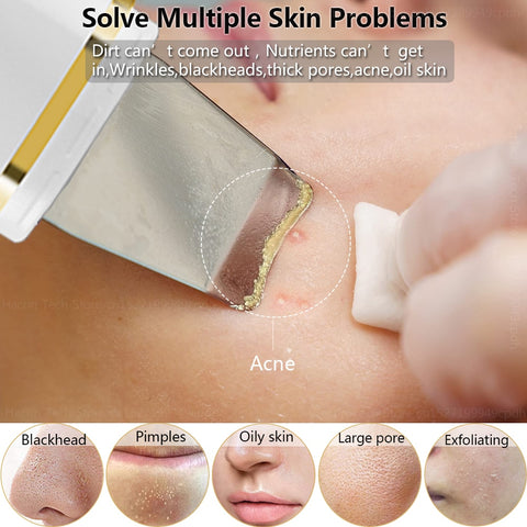 Ultrasonic Skin Scrubber