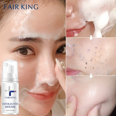 Mousse Peeling Gel