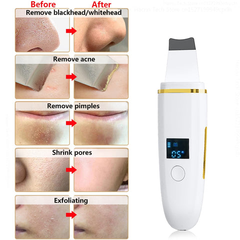 Ultrasonic Skin Scrubber