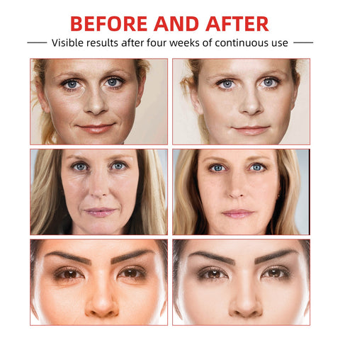 Instant Wrinkle Remover