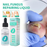 Nail Fungal Treatment