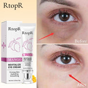 Eye Dark Circles Cream