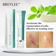 Marks Removal Cream